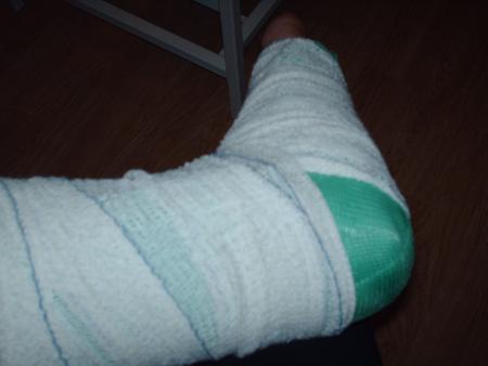 mon povre pied